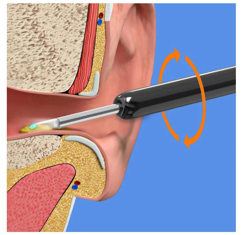 Ear Wax Removal Tool With Camera